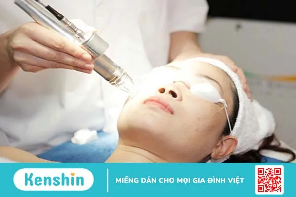 Phương pháp laser màu xung cũng là phương pháp trị sẹo lồi được nhiều chuyên gia đánh giá cao