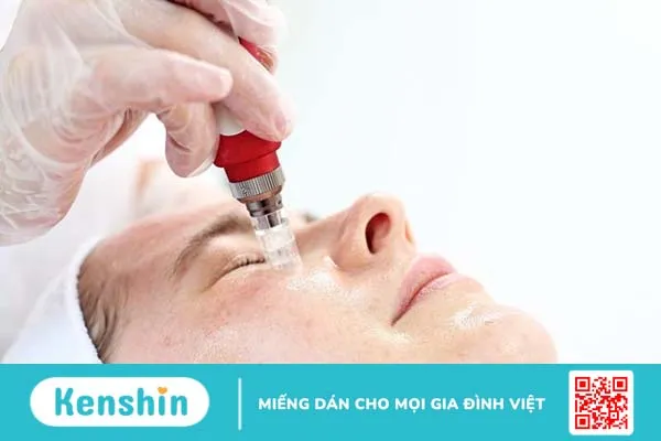 Điều trị lỗ chân lông to bằng lăn kim có tốt không?