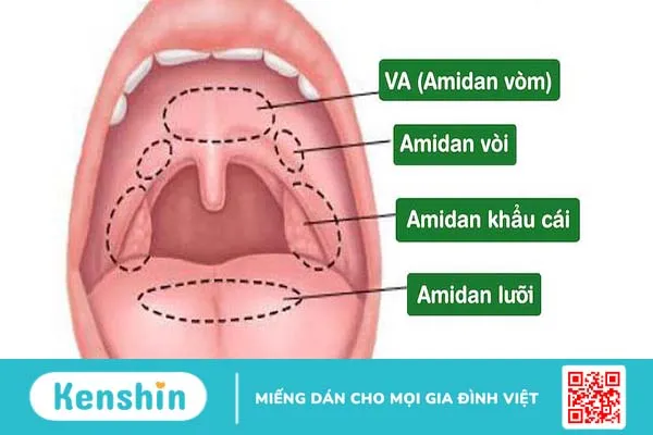 Hai giai đoạn viêm VA cấp tính và viêm VA mạn tính và cách điều trị 1