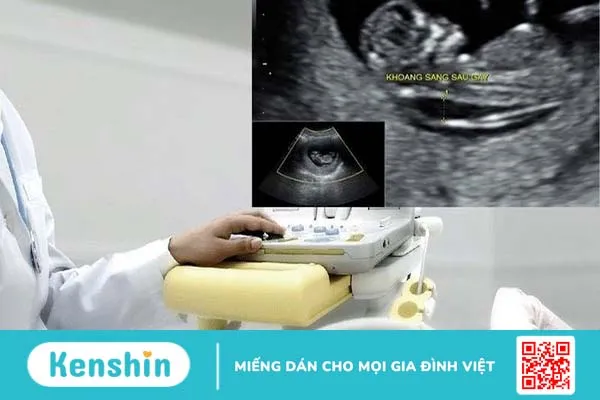 Độ mờ da gáy 3.2mm có bình thường không? 2