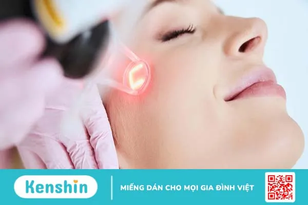 Đốt mụn thịt bằng Laser CO2: Những điều bạn nên biết trước khi thực hiện 3