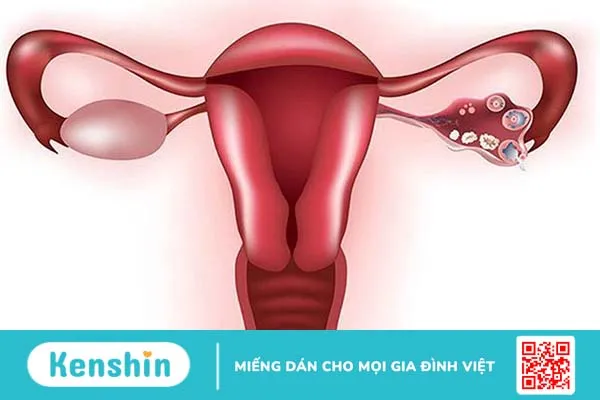 Đừng chủ quan trước những ảnh hưởng của tiêm thuốc rụng trứng đối với cơ thể 2