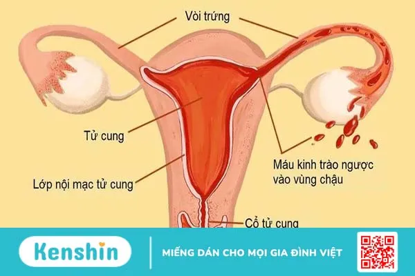 Dùng cốc nguyệt san làm sao đi vệ sinh 1