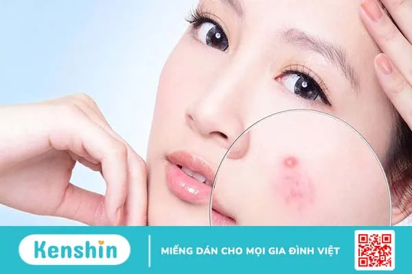 Dung dịch vệ sinh phụ nữ rửa mặt được không 2