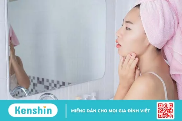 Dùng retinol bị lên mụn xử trí như thế nào?-3