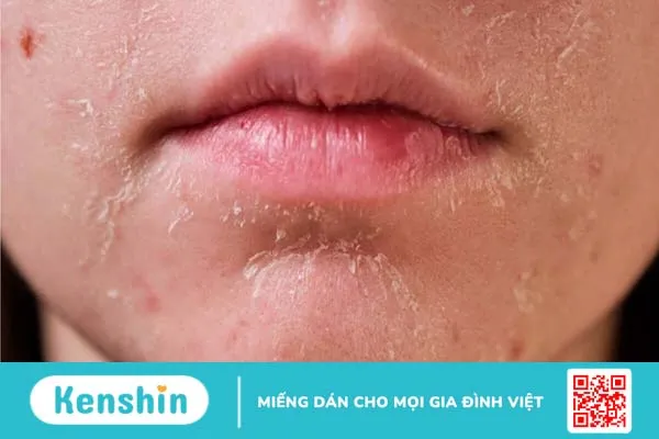 Dưỡng ẩm da mùa lạnh: Phương pháp và lưu ý khi chăm sóc da 1