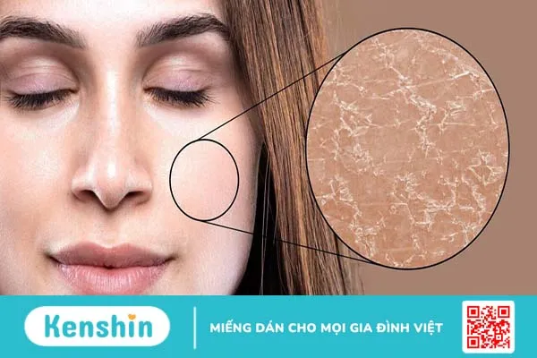 Dưỡng ẩm da - Mẹo ngăn lão hóa da sớm của phụ nữ hiện đại 1