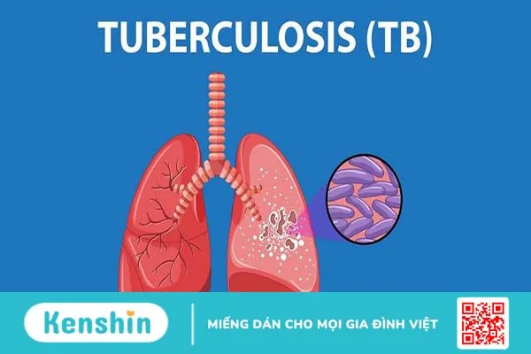 Fucidin có dùng được cho bà bầu không? Một số lưu ý cần biết 4