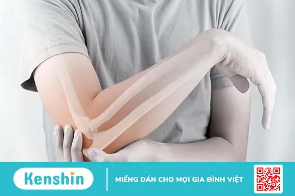 Gãy đầu xa xương cánh tay có triệu chứng gì? Làm thế nào để khắc phục? 1