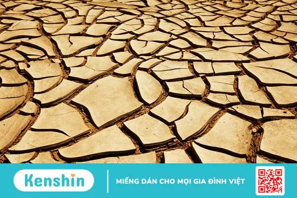 Giải đáp khô hạn sau sinh bao lâu thì hết 1