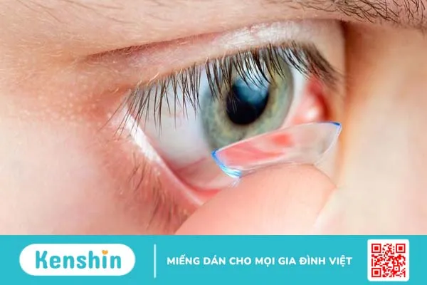 Giải đáp: Kính Ortho-k dùng được bao lâu 3