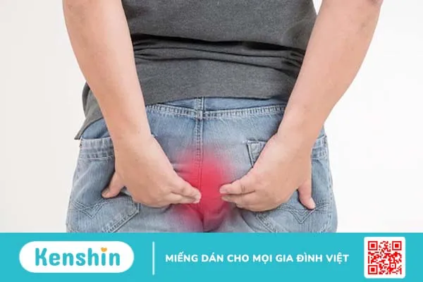 Bệnh trĩ là gì, bệnh trĩ có tái phát không? 1