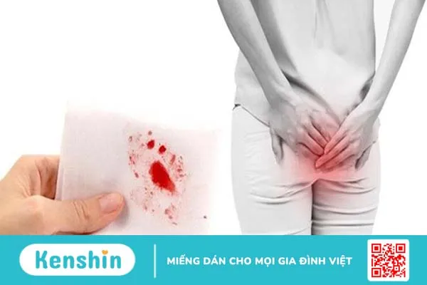 Giải đáp thắc mắc bệnh trĩ có tái phát không? 2