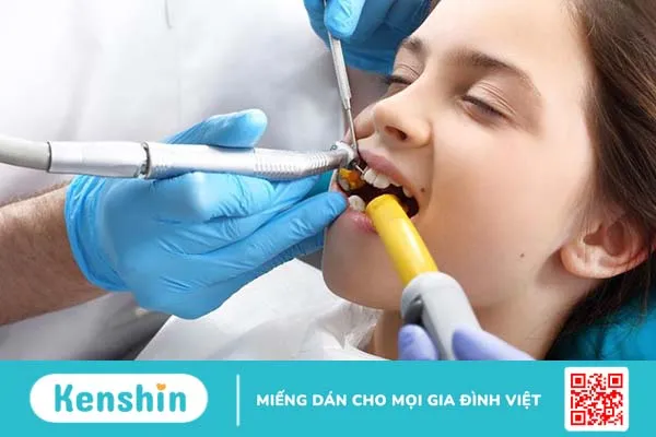 Giải đáp thắc mắc: Niềng răng có phải nhổ răng không 1