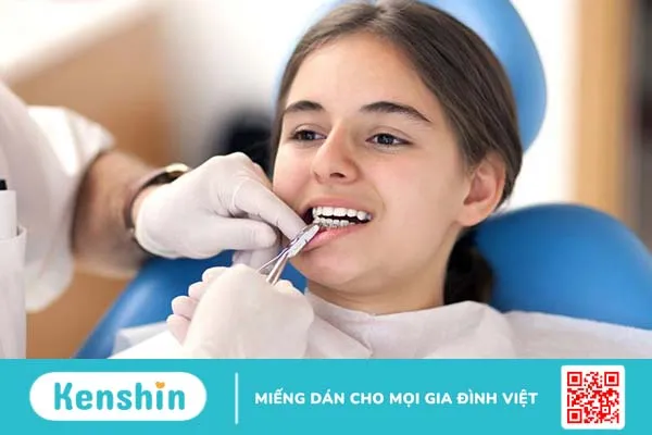 Giải đáp thắc mắc: Niềng răng có phải nhổ răng không 3