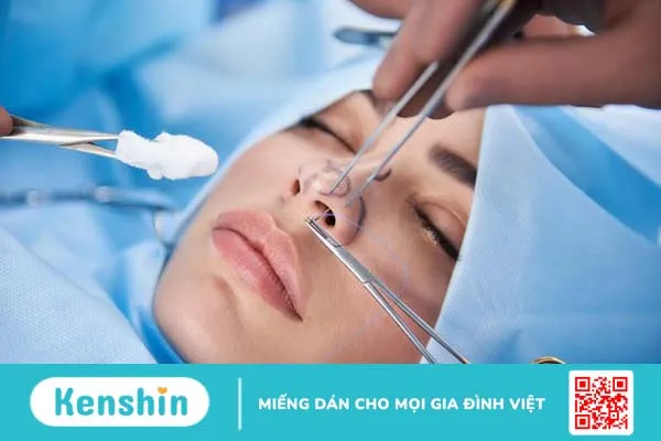 Giải phẫu mũi và các bệnh về mũi thường gặp