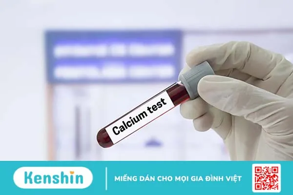 Hạ canxi máu: Tham khảo phác đồ điều trị hạ canxi máu bộ y tế  2