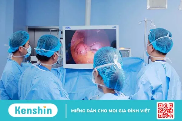 Hạch thần kinh giao cảm và mối liên hệ của triệu chứng đổ mồ cơ thể 3