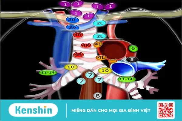 Hạch trung thất là gì? Các bệnh lý liên quan đến hạch trung thất 2