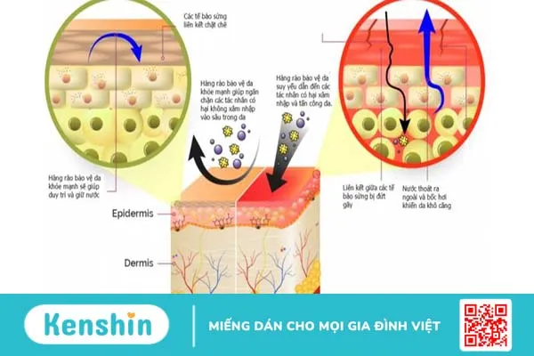 Hàng rào bảo vệ da là gì? Cách chăm sóc hàng rào bảo vệ da 1