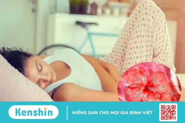 Hậu quả của viêm lộ tuyến cổ tử cung đến sức khỏe phụ nữ mà bạn không nên bỏ qua 2