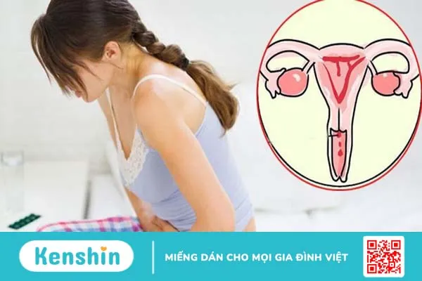 Hậu quả của viêm lộ tuyến cổ tử cung đến sức khỏe phụ nữ mà bạn không nên bỏ qua 3