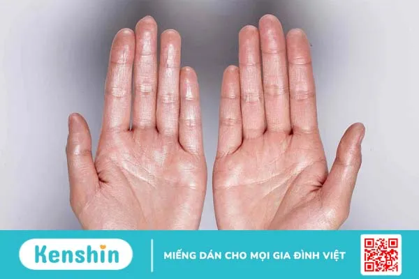 Hệ lụy của rối loạn thần kinh thực vật là gì? 3