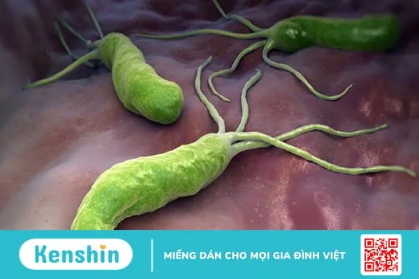 Helicobacter pylori Ag test nhanh là gì? Các phương pháp xét nghiệm phổ biến nhất 2