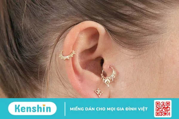 Bấm lỗ tai bị chảy nước vàng phải làm sao?