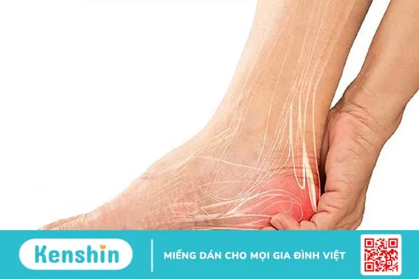 Hiểu về tình trạng đá bóng bị đau gót chân và cách phòng tránh 1