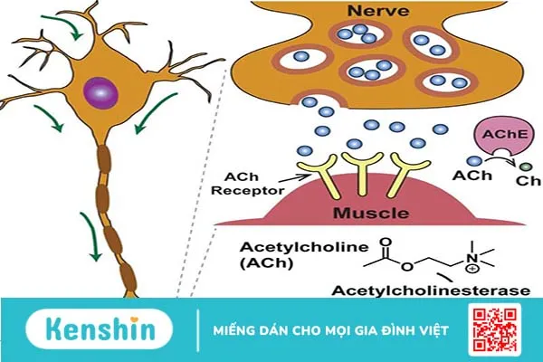 Hội chứng nhược cơ Lambert-Eaton: Dấu hiệu, nguyên nhân và cách điều trị 2