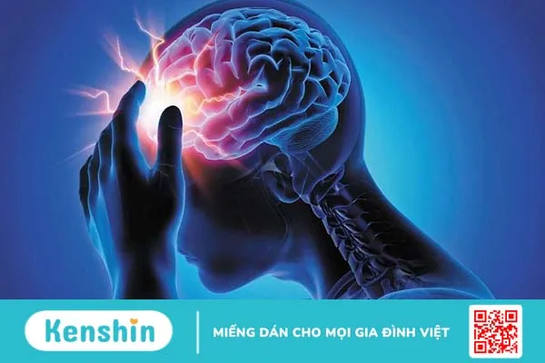 Hội chứng tiền đình cấp là gì Triệu chứng và cách điều trị ra sao 4