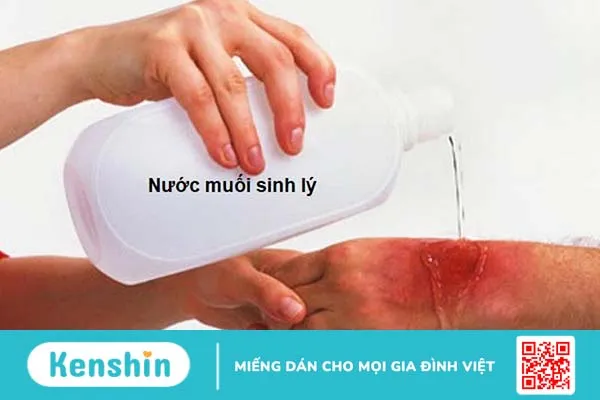 Hướng dẫn cách băng bó vết thương đúng chuẩn 1