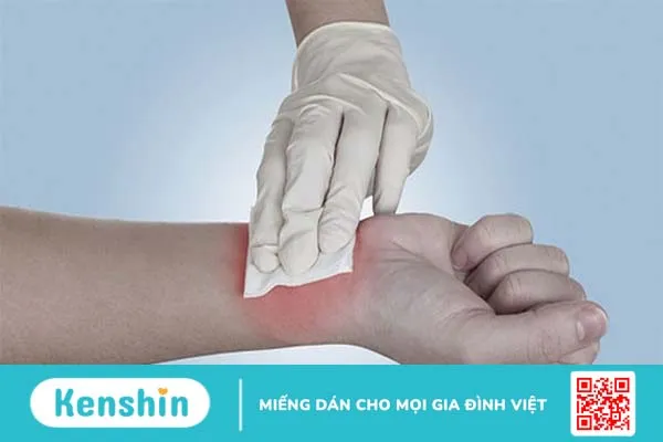 Hướng dẫn cách băng bó vết thương đúng chuẩn 2