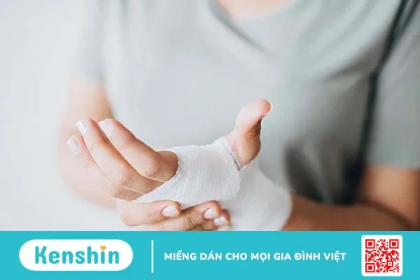 Hướng dẫn cách băng bó vết thương đúng chuẩn 3