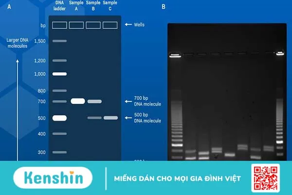 huong-dan-cach-doc-ket-qua-dien-di-dna 2