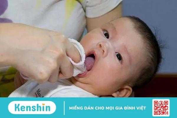 Cách rơ lưỡi cho trẻ sơ sinh đúng cách và an toàn 3