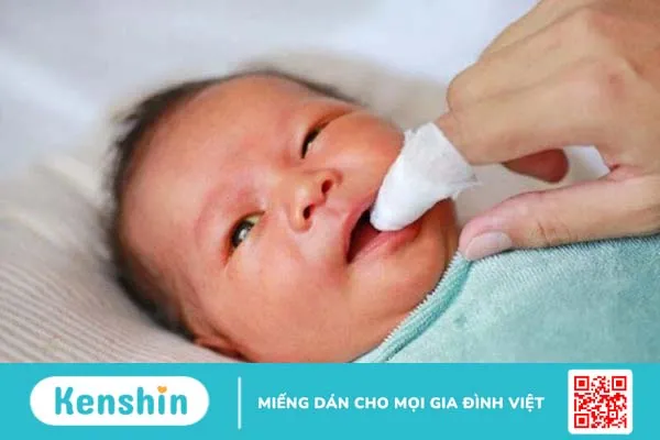 Cách rơ lưỡi cho trẻ sơ sinh đúng cách và an toàn 2