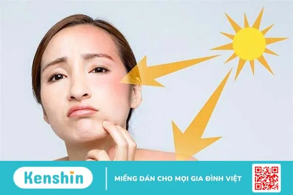 Hướng dẫn cách test kem chống nắng để tránh kích ứng 1