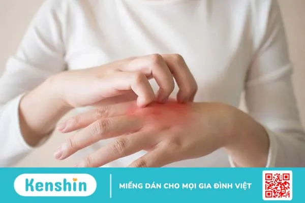 Hướng dẫn điều trị viêm mô tế bào đúng cách 2