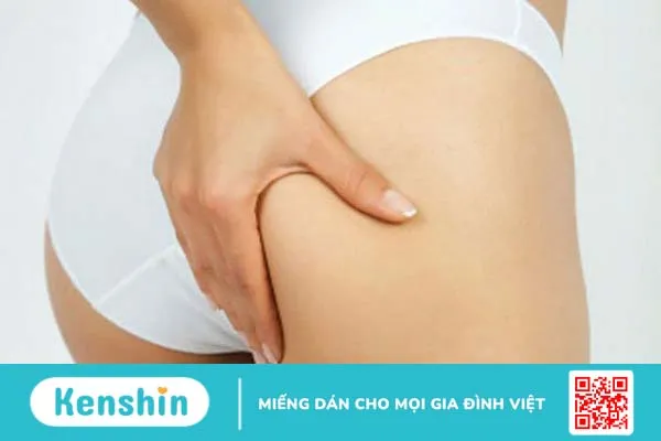 trị rạn da mông bằng dầu dừa 3