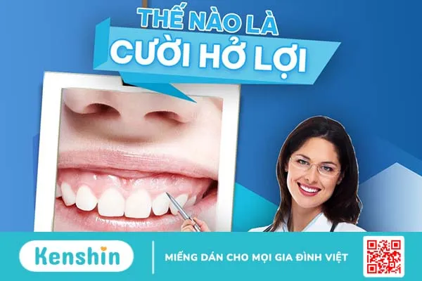 Hướng điều trị cười hở lợi và những lưu ý khi điều trị cười hở lợi 1