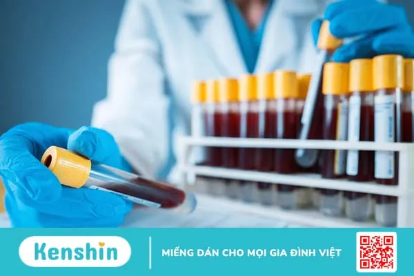 Igm là gì? Ý nghĩ của nó trong xét nghiệm chuyên khoa 1