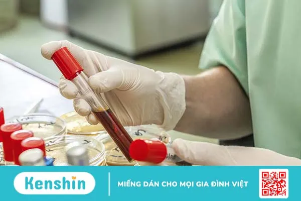 Igm là gì? Ý nghĩ của nó trong xét nghiệm chuyên khoa 2