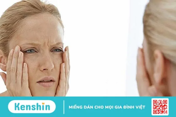 Kem bôi babolica bán ở đâu ? Giá bán bao nhiêu 3