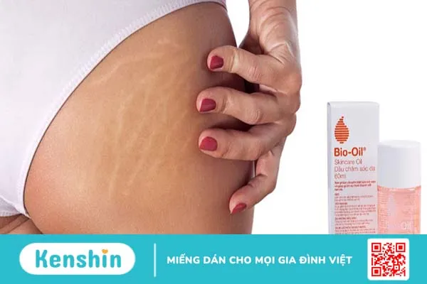 kem trị rạn da mông 1