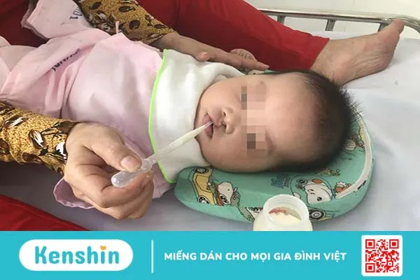 Khe hở vòm miệng: Nguyên nhân và lưu ý khi điều trị 2