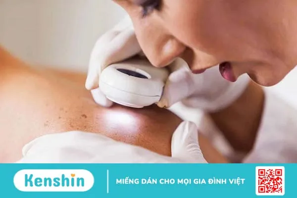 Khi bị giời leo cần có chế độ nghỉ ngơi ăn uống hợp lý