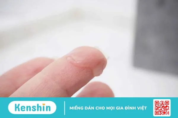 Khí hư bã đậu ra nhiều và gây ngứa phải làm sao? 1