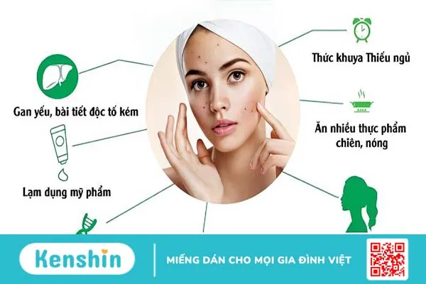 Không nặn mụn có tự hết không? 1